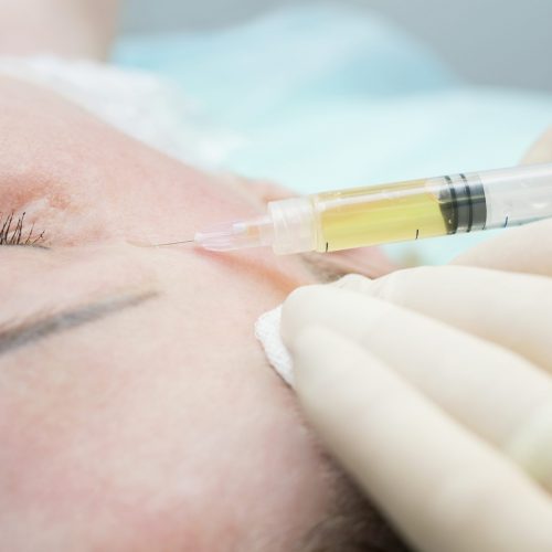 Beautician procedure Plasmolifting injection